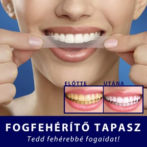 EELHOE Fogfehérítő Tapasz
