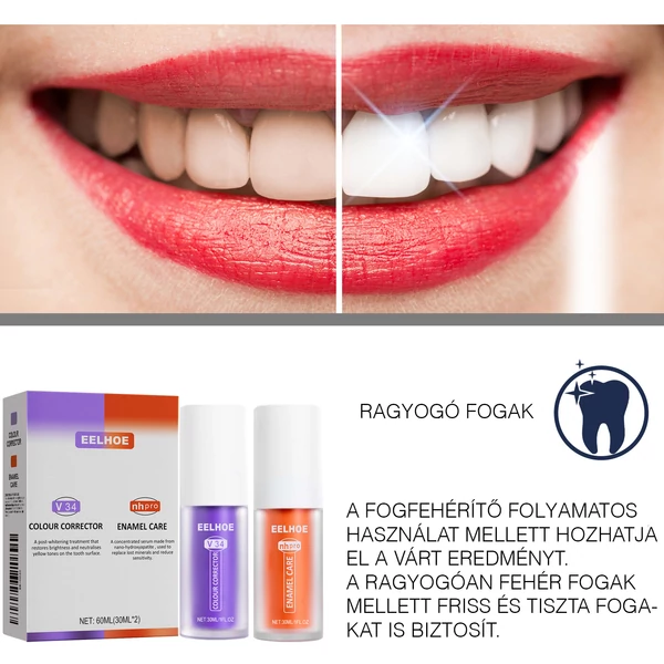 EELHOE Kétfázisú Fogfehérítő Gél - 2 x 30 ml