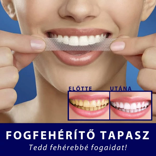 EELHOE Fogfehérítő Tapasz