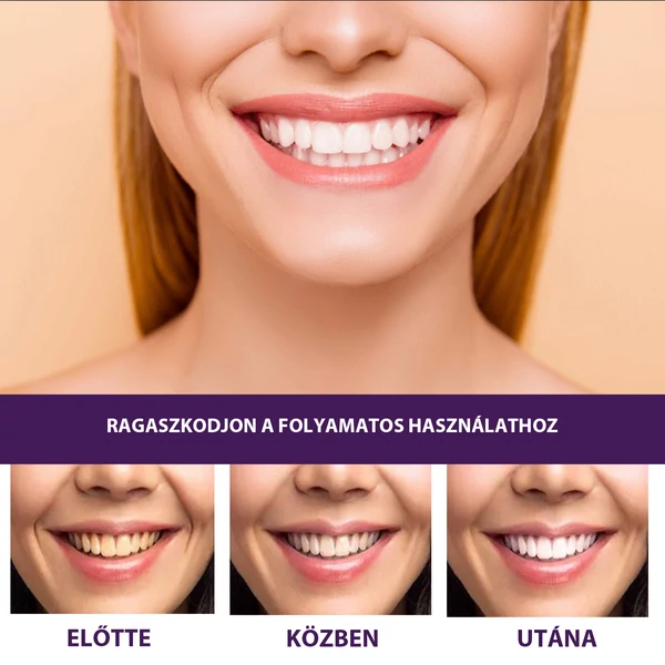 EELHOE Fogfehérítő Gél - 50 ml