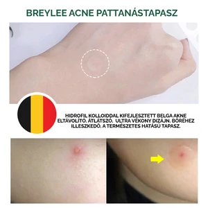 BREYLEE Átlátszó Pattanás Eltávolító Tapasz