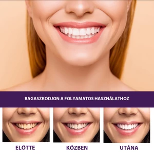 EELHOE Fogfehérítő Gél - 50 ml