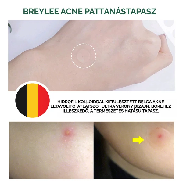 BREYLEE Átlátszó Pattanás Eltávolító Tapasz