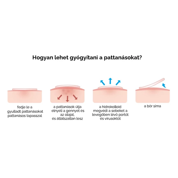 Nappali Változat